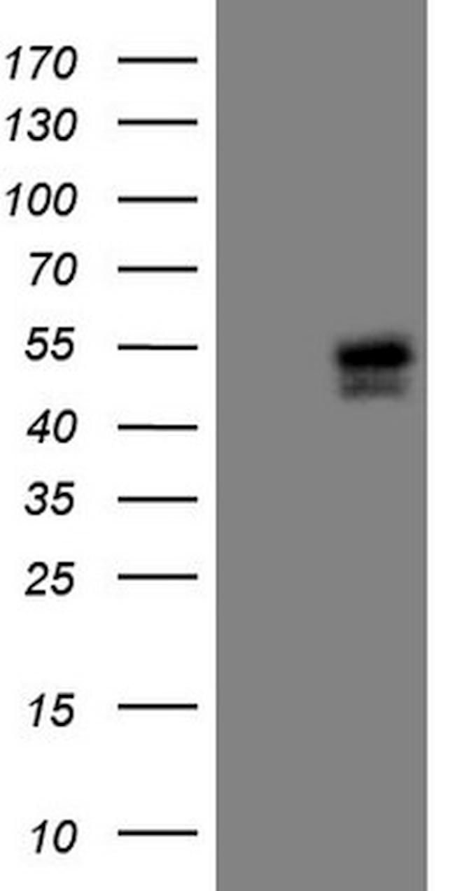 ISL1 Antibody in Western Blot (WB)