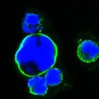 ISL1 Antibody in Immunocytochemistry (ICC/IF)