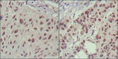 ISL1 Antibody in Immunohistochemistry (Paraffin) (IHC (P))