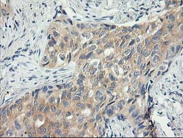 ITFG2 Antibody in Immunohistochemistry (Paraffin) (IHC (P))