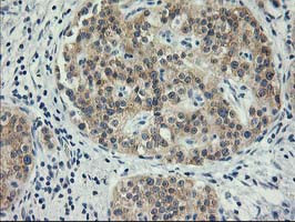 ITFG2 Antibody in Immunohistochemistry (Paraffin) (IHC (P))