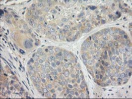 ITFG2 Antibody in Immunohistochemistry (Paraffin) (IHC (P))