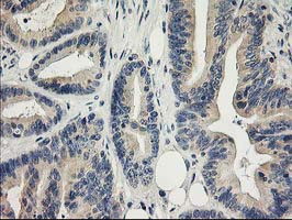 ITFG2 Antibody in Immunohistochemistry (Paraffin) (IHC (P))