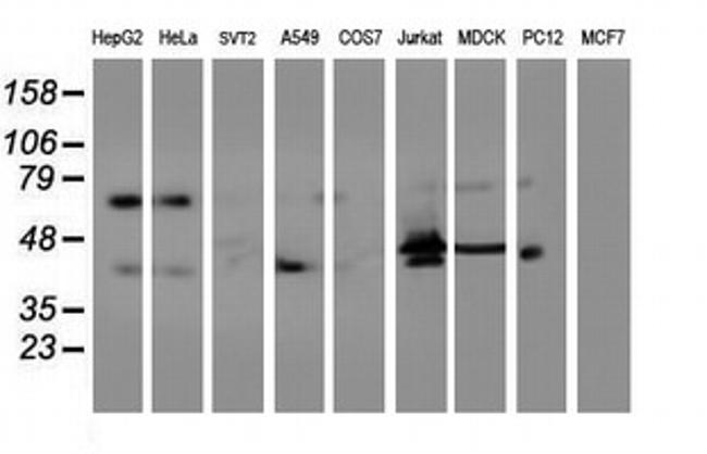 ITFG2 Antibody in Western Blot (WB)