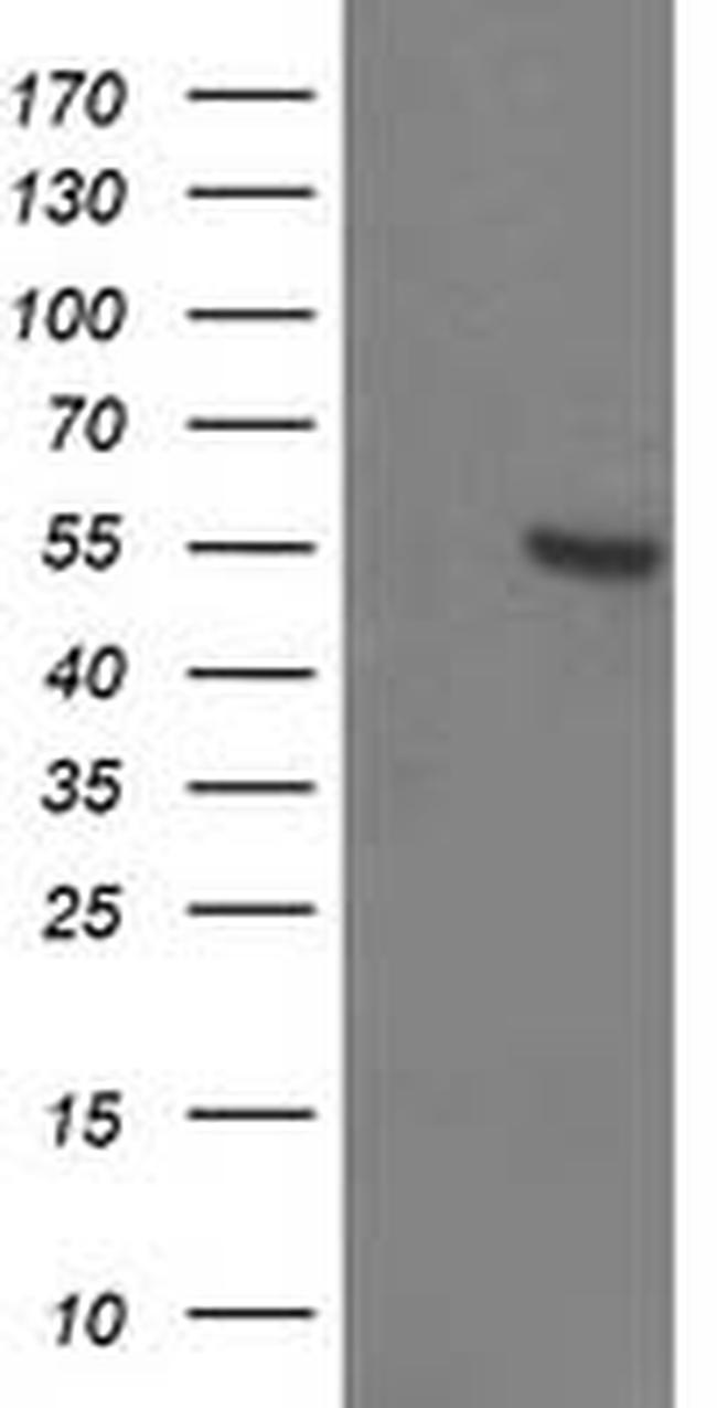 ITFG2 Antibody in Western Blot (WB)