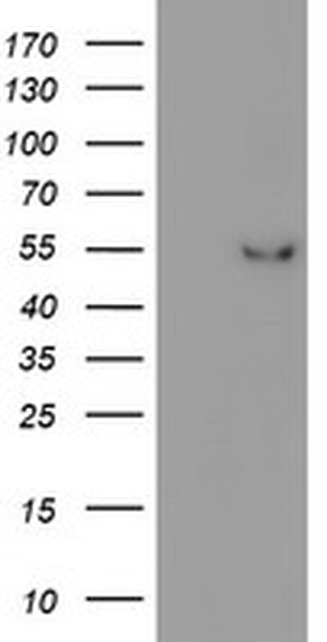 ITFG2 Antibody in Western Blot (WB)