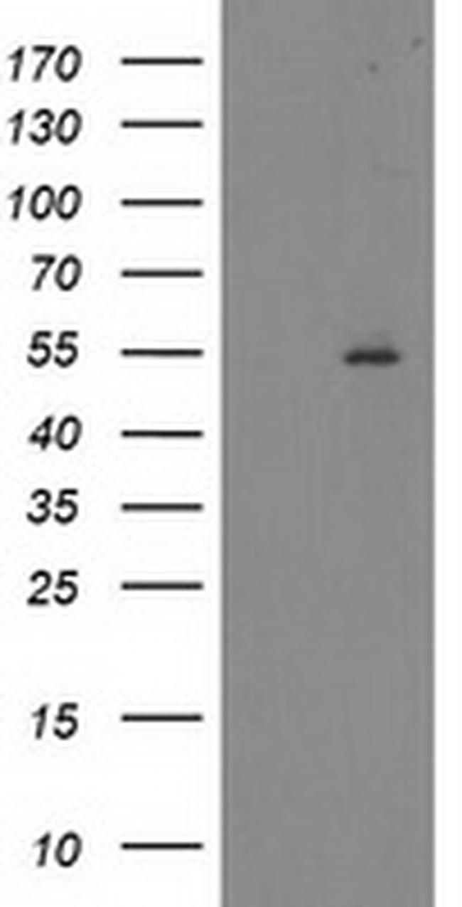 ITFG2 Antibody in Western Blot (WB)