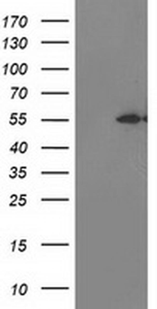 ITFG2 Antibody in Western Blot (WB)