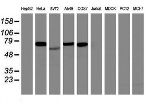 ITFG2 Antibody in Western Blot (WB)