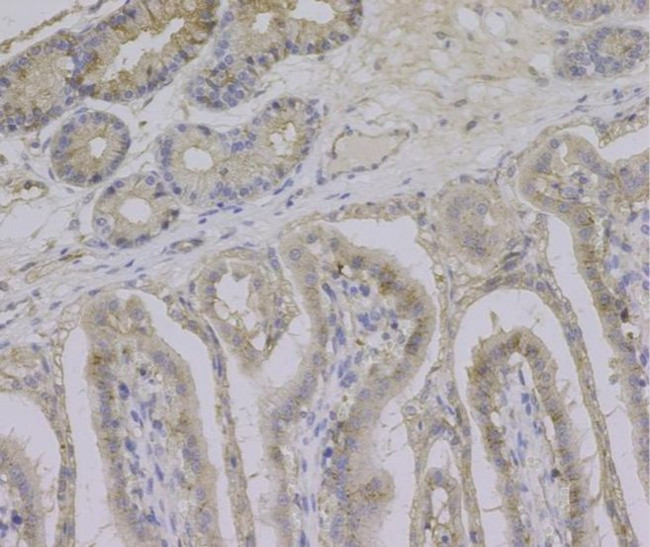 ITGB1 Antibody in Immunohistochemistry (Paraffin) (IHC (P))