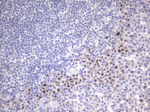 ITGB1BP1 Antibody in Immunohistochemistry (Paraffin) (IHC (P))