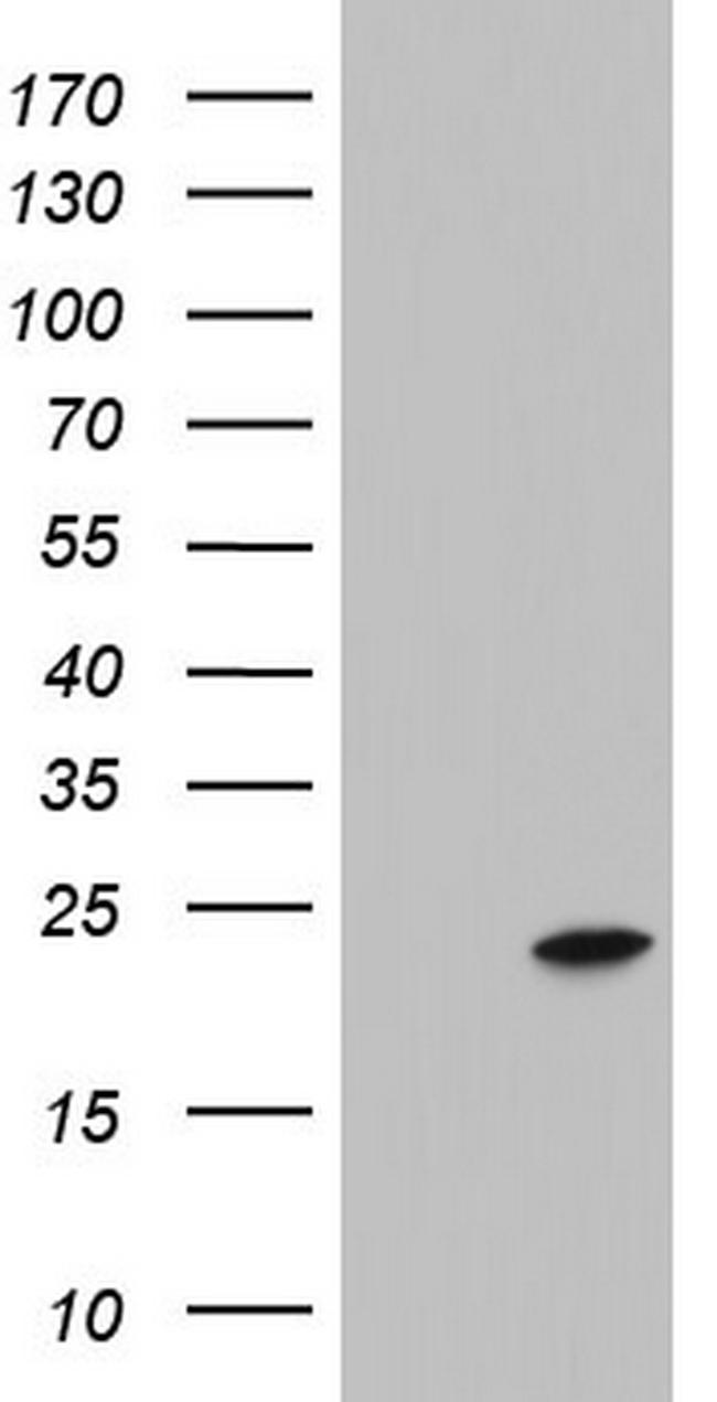 ITGB1BP1 Antibody in Western Blot (WB)