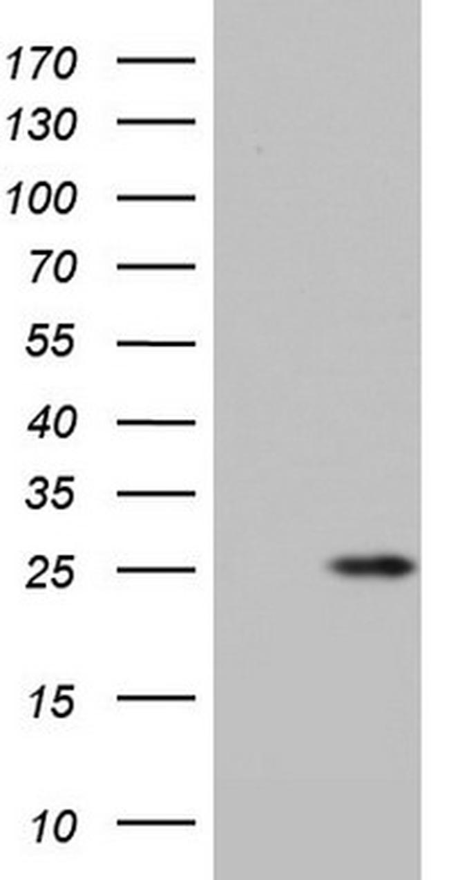 ITGB1BP1 Antibody in Western Blot (WB)