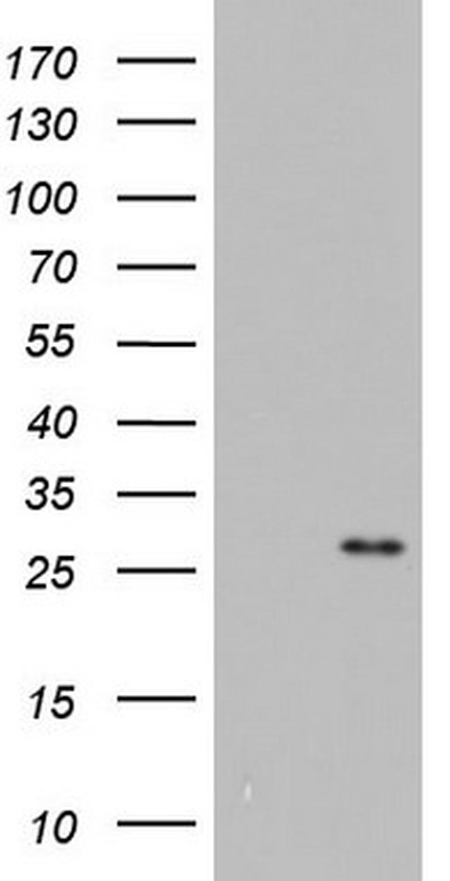 ITGB1BP1 Antibody in Western Blot (WB)