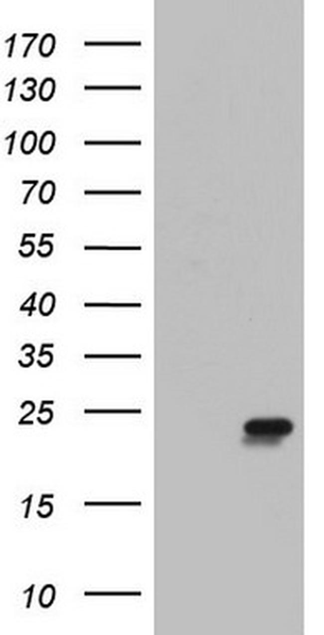 ITGB1BP1 Antibody in Western Blot (WB)