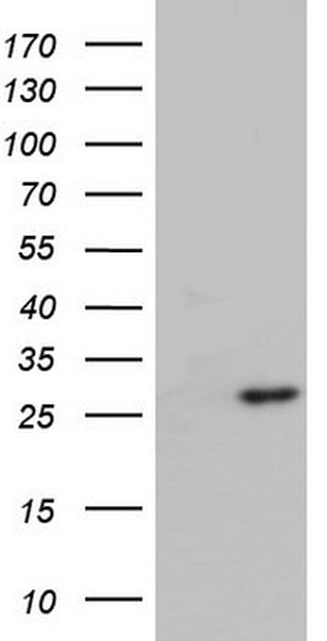 ITGB1BP1 Antibody in Western Blot (WB)