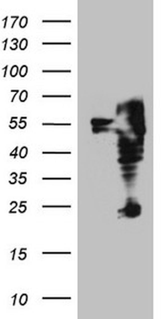 ITPK1 Antibody in Western Blot (WB)