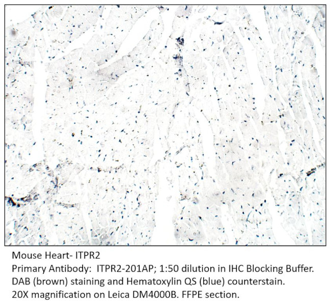 ITPR2 Antibody in Immunohistochemistry (IHC)