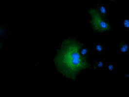 IVD Antibody in Immunocytochemistry (ICC/IF)