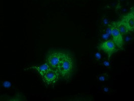 IVD Antibody in Immunocytochemistry (ICC/IF)