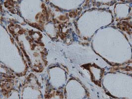 IVD Antibody in Immunohistochemistry (Paraffin) (IHC (P))