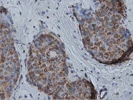 IVD Antibody in Immunohistochemistry (Paraffin) (IHC (P))