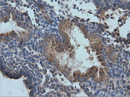 IVD Antibody in Immunohistochemistry (Paraffin) (IHC (P))