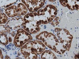 IVD Antibody in Immunohistochemistry (Paraffin) (IHC (P))