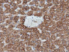 IVD Antibody in Immunohistochemistry (Paraffin) (IHC (P))