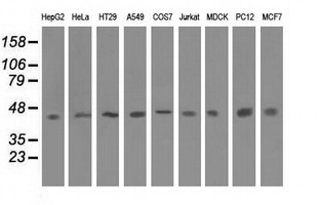 IVD Antibody in Western Blot (WB)