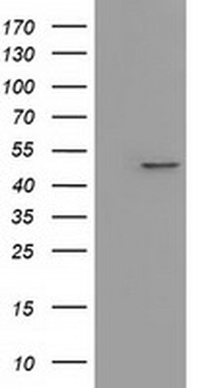 IVD Antibody in Western Blot (WB)