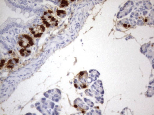 IdU Antibody in Immunohistochemistry (Paraffin) (IHC (P))