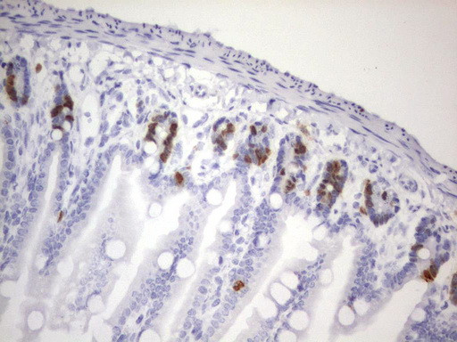 IdU Antibody in Immunohistochemistry (Paraffin) (IHC (P))