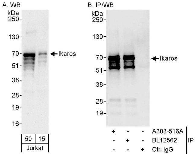 Ikaros Antibody in Western Blot (WB)