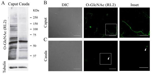 O-linked N-acetylglucosamine (O-GlcNAc) Antibody in Western Blot (WB)