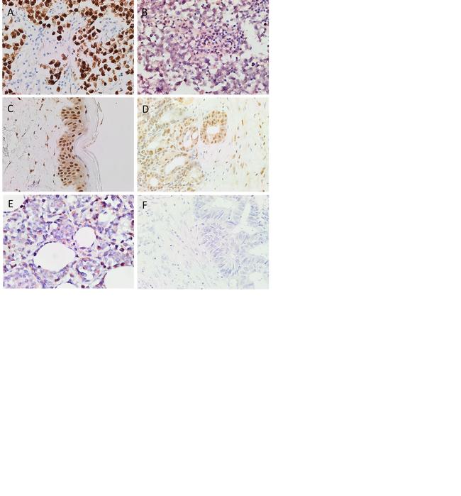 SOX2 Antibody in Immunohistochemistry (IHC)