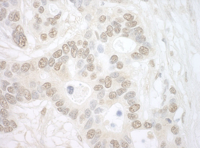 Importin 4 Antibody in Immunohistochemistry (IHC)