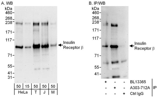 Insulin Receptor Beta Antibody in Western Blot (WB)