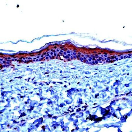 Involucrin Antibody in Immunohistochemistry (Paraffin) (IHC (P))