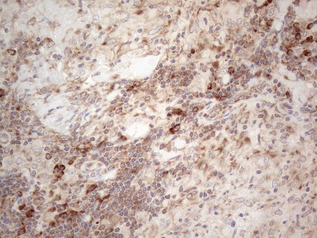 JAG1 Antibody in Immunohistochemistry (Paraffin) (IHC (P))