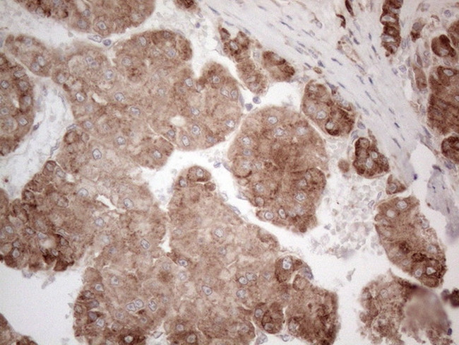 JAG1 Antibody in Immunohistochemistry (Paraffin) (IHC (P))