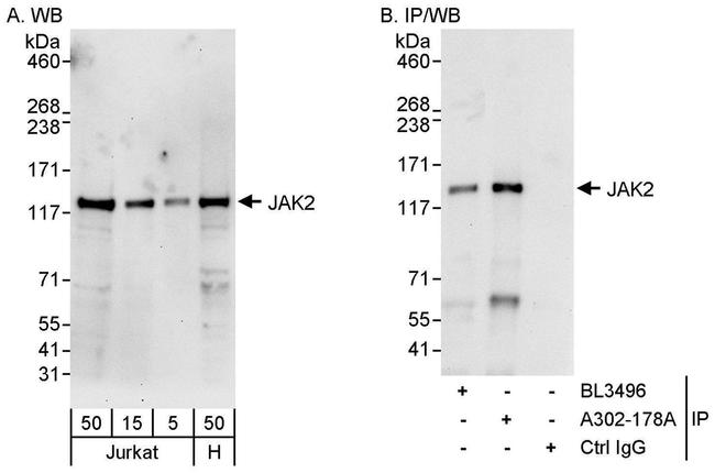 JAK2 Antibody in Western Blot (WB)