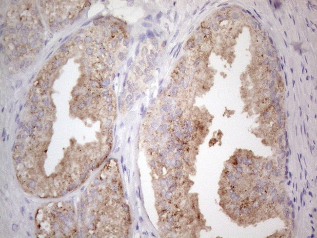 JAK2 Antibody in Immunohistochemistry (Paraffin) (IHC (P))