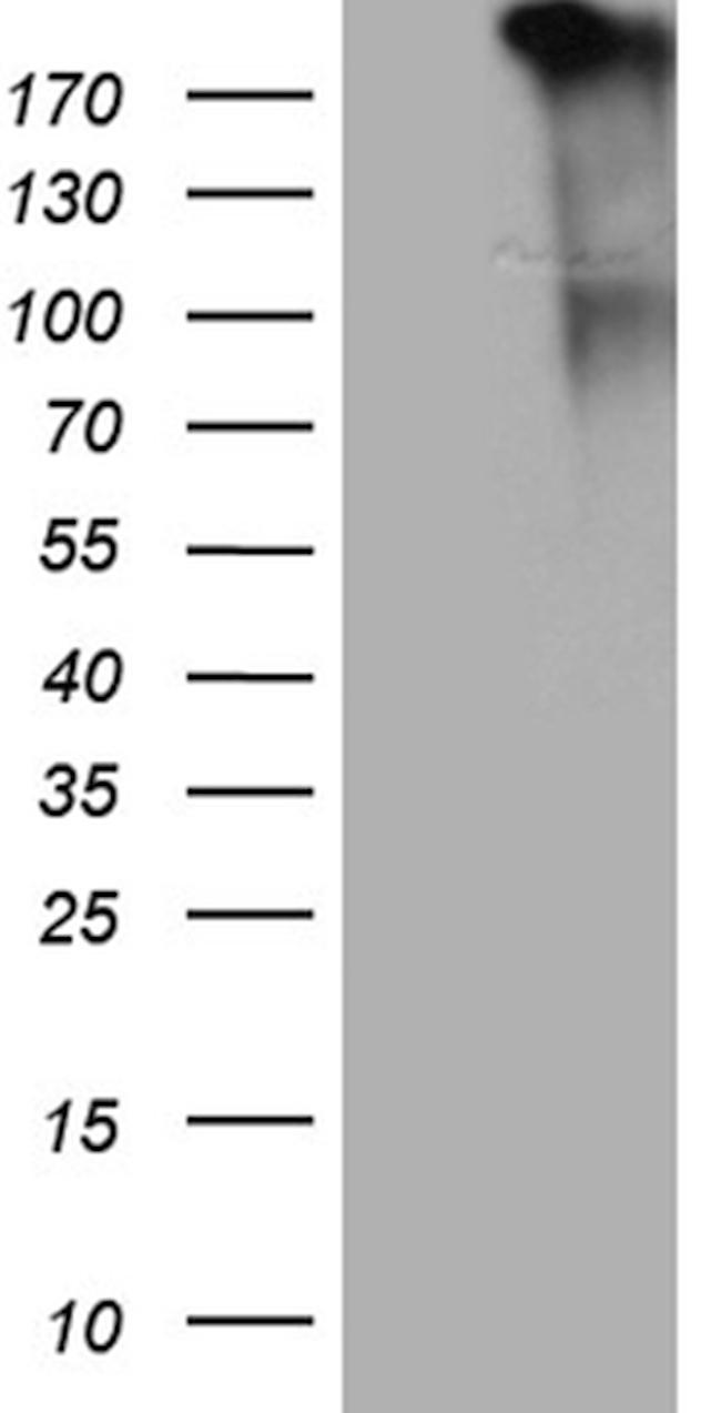 JAK2 Antibody in Western Blot (WB)