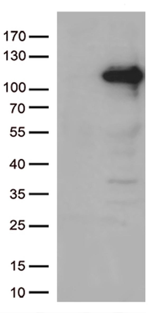 JAK3 Antibody in Western Blot (WB)