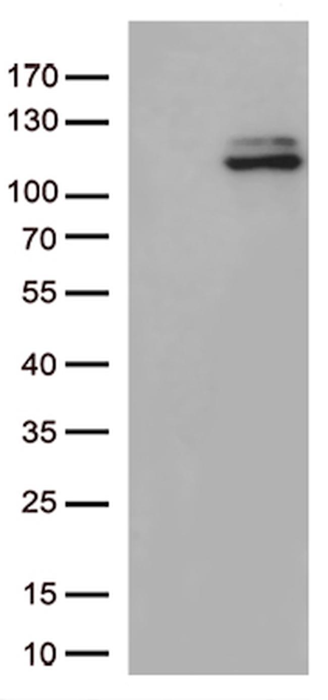 JAK3 Antibody in Western Blot (WB)