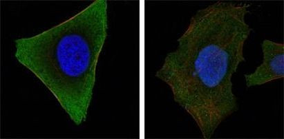 JAK3 Antibody in Immunocytochemistry (ICC/IF)