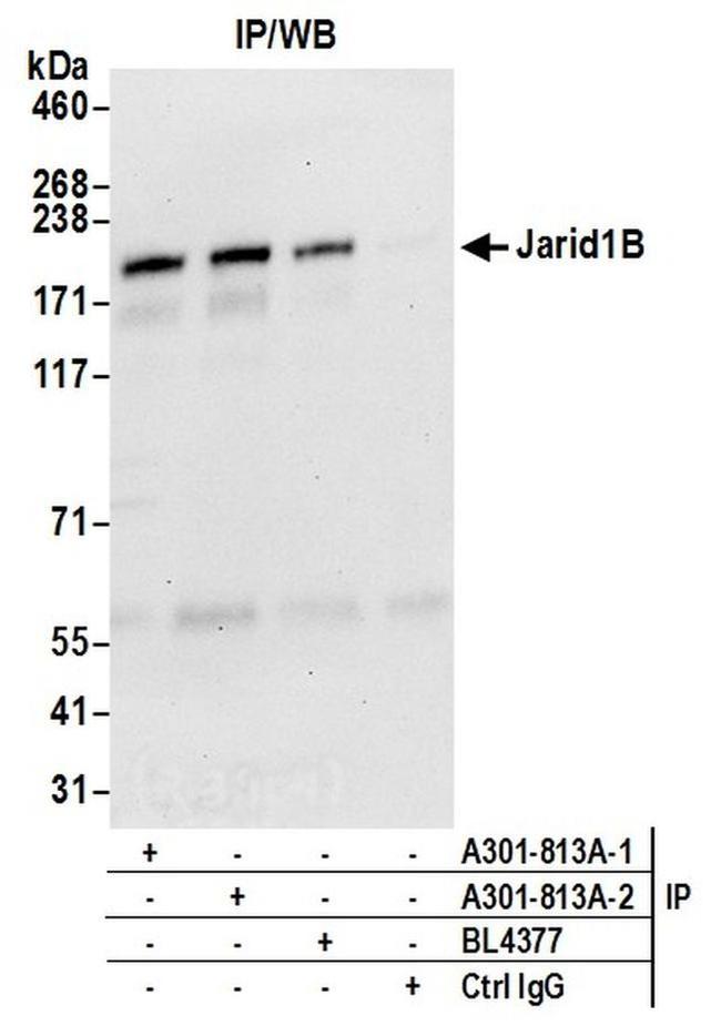 JARID1B Antibody in Western Blot (WB)