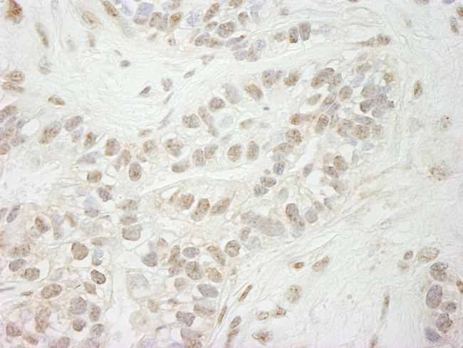 JARID1B Antibody in Immunohistochemistry (IHC)