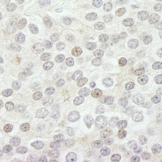 JARID1B Antibody in Immunohistochemistry (IHC)